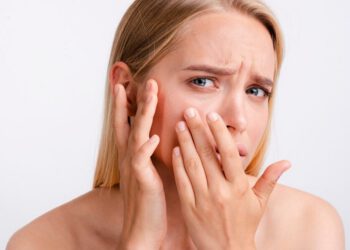 przebarwienia skorne